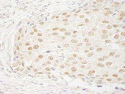 Immunohistochemistry-Paraffin: FBXW7/Cdc4 Antibody [NB100-88139]