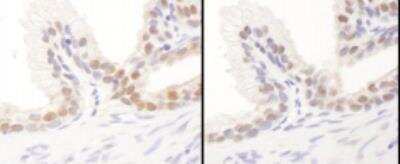 Immunohistochemistry-Paraffin: FBXW7/Cdc4 Antibody [NB100-88139]