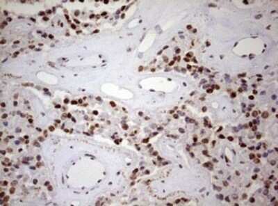 Immunohistochemistry: FBXW7/Cdc4 Antibody (OTI6F5) - Azide and BSA Free [NBP2-71995]
