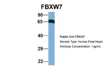 Western Blot: FBXW7/Cdc4 Antibody [NBP1-59631]