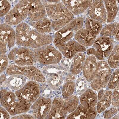 Immunohistochemistry: FBXW8 Antibody [NBP2-38429]