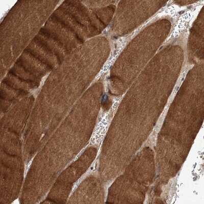 Immunohistochemistry-Paraffin: FBXW8 Antibody [NBP1-84715]