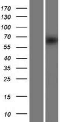 Western Blot: FBXW8 Overexpression Lysate [NBP2-05259]