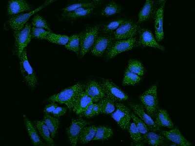 Immunocytochemistry/ Immunofluorescence: FBXW9 Antibody [NBP2-97608]