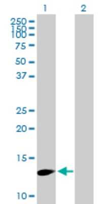 Western Blot: FBXW9 Antibody [H00084261-B01P]