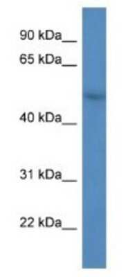 Western Blot: FBXW9 Antibody [NBP1-79823]