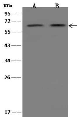 Western Blot: FCAMR Antibody [NBP2-99555]