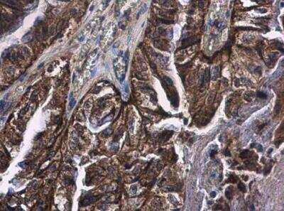 Immunohistochemistry-Paraffin: FCAR/CD89 Antibody [NBP2-15820]