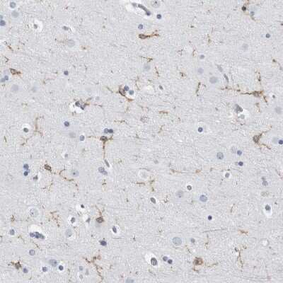 Immunohistochemistry-Paraffin: FCER1G Antibody [NBP1-85959]