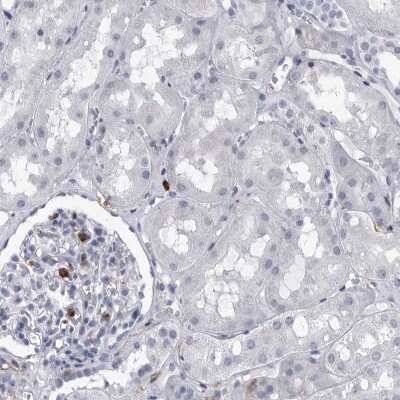 Immunohistochemistry-Paraffin: FCER1G Antibody [NBP1-85959]