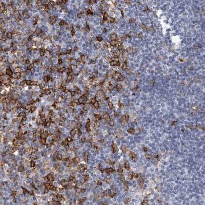 Immunohistochemistry-Paraffin: FCER1G Antibody [NBP1-85959]