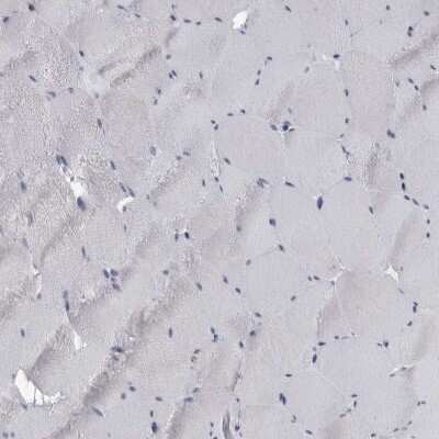 Immunohistochemistry-Paraffin: FCER1G Antibody [NBP1-85959]