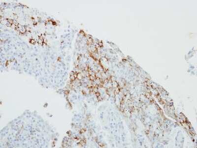 Immunohistochemistry-Paraffin: FCER1G Antibody [NBP2-16456]