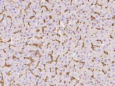 Immunohistochemistry-Paraffin: FCER1G Antibody [NBP3-06225]