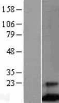 Western Blot: FCER1G Overexpression Lysate [NBL1-10651]