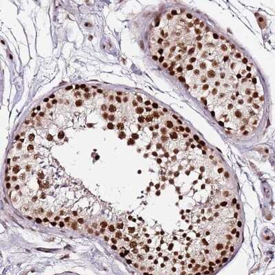 Immunohistochemistry-Paraffin: FCF1 Antibody [NBP1-91893]