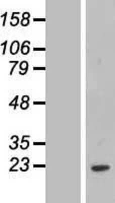 Western Blot: FCF1 Overexpression Lysate [NBL1-10653]