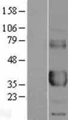 Western Blot: Fc gamma RIIA/CD32a Overexpression Lysate [NBL1-10655]