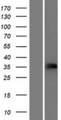 Western Blot: FCGR2C Overexpression Lysate [NBP2-04598]