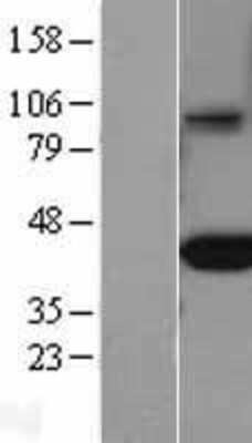 Western Blot: FCRN/FCGRT Overexpression Lysate [NBL1-10660]