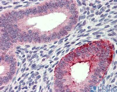 Immunohistochemistry: FCHO1 Antibody [NBP1-79578]