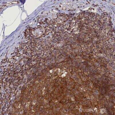 Immunohistochemistry-Paraffin: FCHO1 Antibody [NBP1-81523]