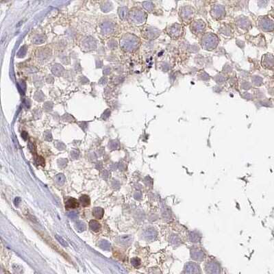 Immunohistochemistry-Paraffin: FCHO2 Antibody [NBP1-90904]