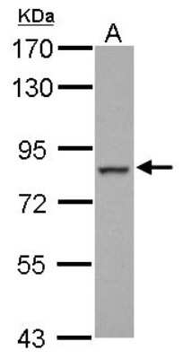 Western Blot: FCHO2 Antibody [NBP2-16460]