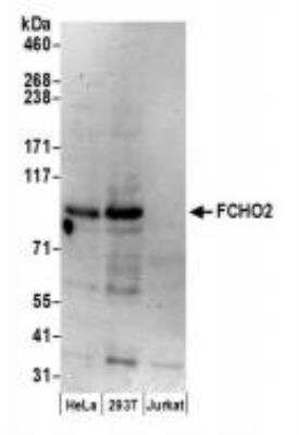 Western Blot: FCHO2 Antibody [NBP2-36524]