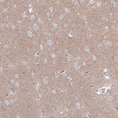Immunohistochemistry-Paraffin: FCHSD2 Antibody [NBP1-81479]