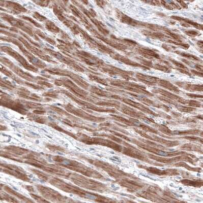 Immunohistochemistry-Paraffin: FCHSD2 Antibody [NBP1-81479]