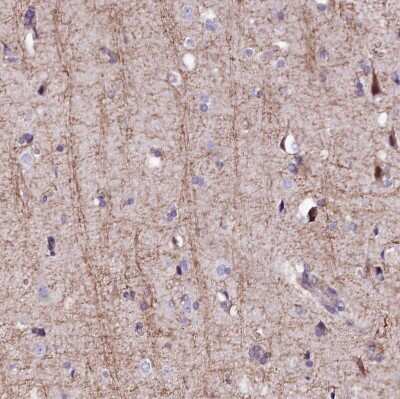 Immunohistochemistry-Paraffin: FCHSD2 Antibody [NBP2-38415]