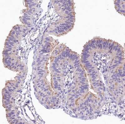 Immunohistochemistry-Paraffin: FCHSD2 Antibody [NBP2-38415]