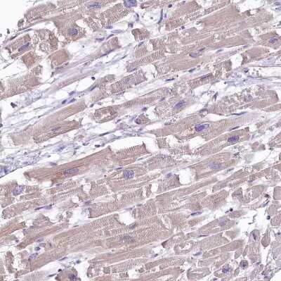 Immunohistochemistry-Paraffin: FCHSD2 Antibody [NBP2-38415]