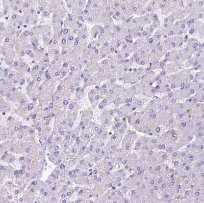 Immunohistochemistry-Paraffin: FCHSD2 Antibody [NBP2-38415]