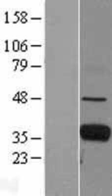 Western Blot: Ficolin-1 Overexpression Lysate [NBL1-10662]