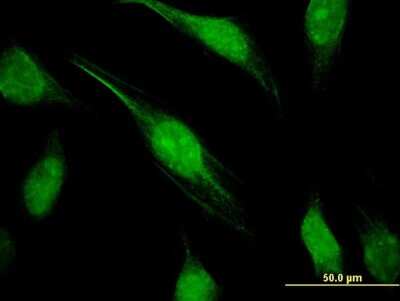Immunocytochemistry/ Immunofluorescence: FCP1 Antibody (3G4) [H00009150-M04]