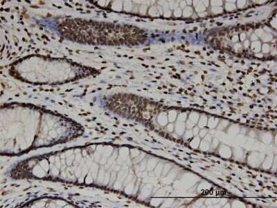 Immunohistochemistry-Paraffin: FCP1 Antibody (3G4) [H00009150-M04]