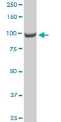 Western Blot: FCP1 Antibody (3G4) [H00009150-M04]