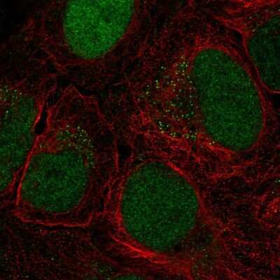 Immunocytochemistry/ Immunofluorescence: FCP1 Antibody [NBP2-68899]