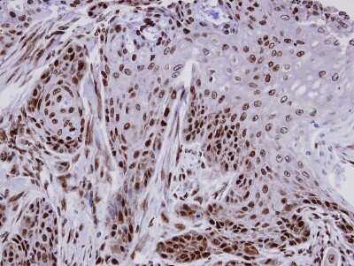 Immunohistochemistry-Paraffin: FCP1 Antibody [NBP1-31472]
