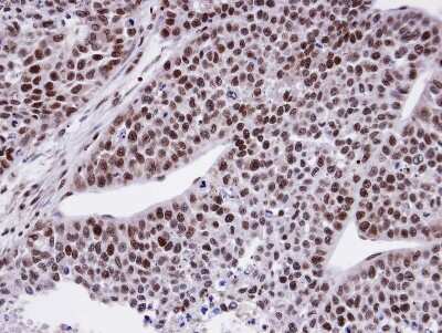 Immunohistochemistry-Paraffin: FCP1 Antibody [NBP1-31472]