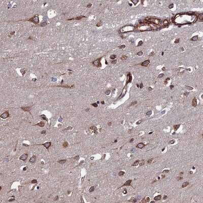 Immunohistochemistry-Paraffin: FCP1 Antibody [NBP1-84704]