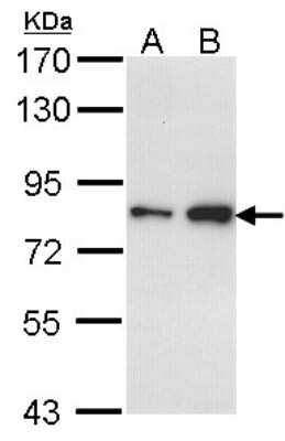 Western Blot: FCP1 Antibody [NBP1-31472]