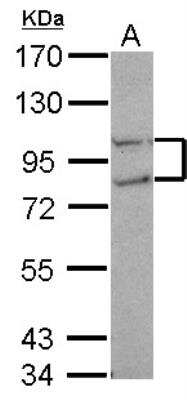 Western Blot: FCP1 Antibody [NBP2-16461]