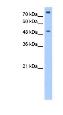 Western Blot: FCRL1/FcRH1 Antibody [NBP1-62286]