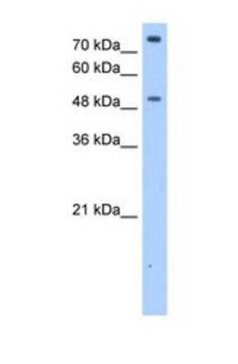 Western Blot: FCRL1/FcRH1 Antibody [NBP1-69316]