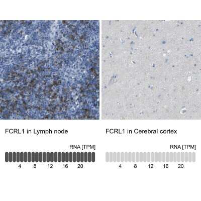 Immunohistochemistry-Paraffin: FCRL1/FcRH1 Antibody [NBP1-84703]