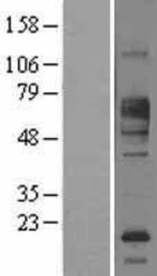 Western Blot: FCRL1/FcRH1 Overexpression Lysate [NBL1-10664]