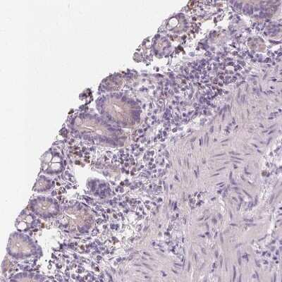 Immunohistochemistry-Paraffin: FCRL3/FcRH3 Antibody [NBP2-62615]